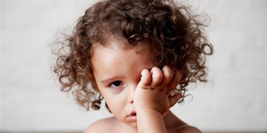 أسباب
      ظهور
      الهالات
      السوداء
      عند
      الأطفال